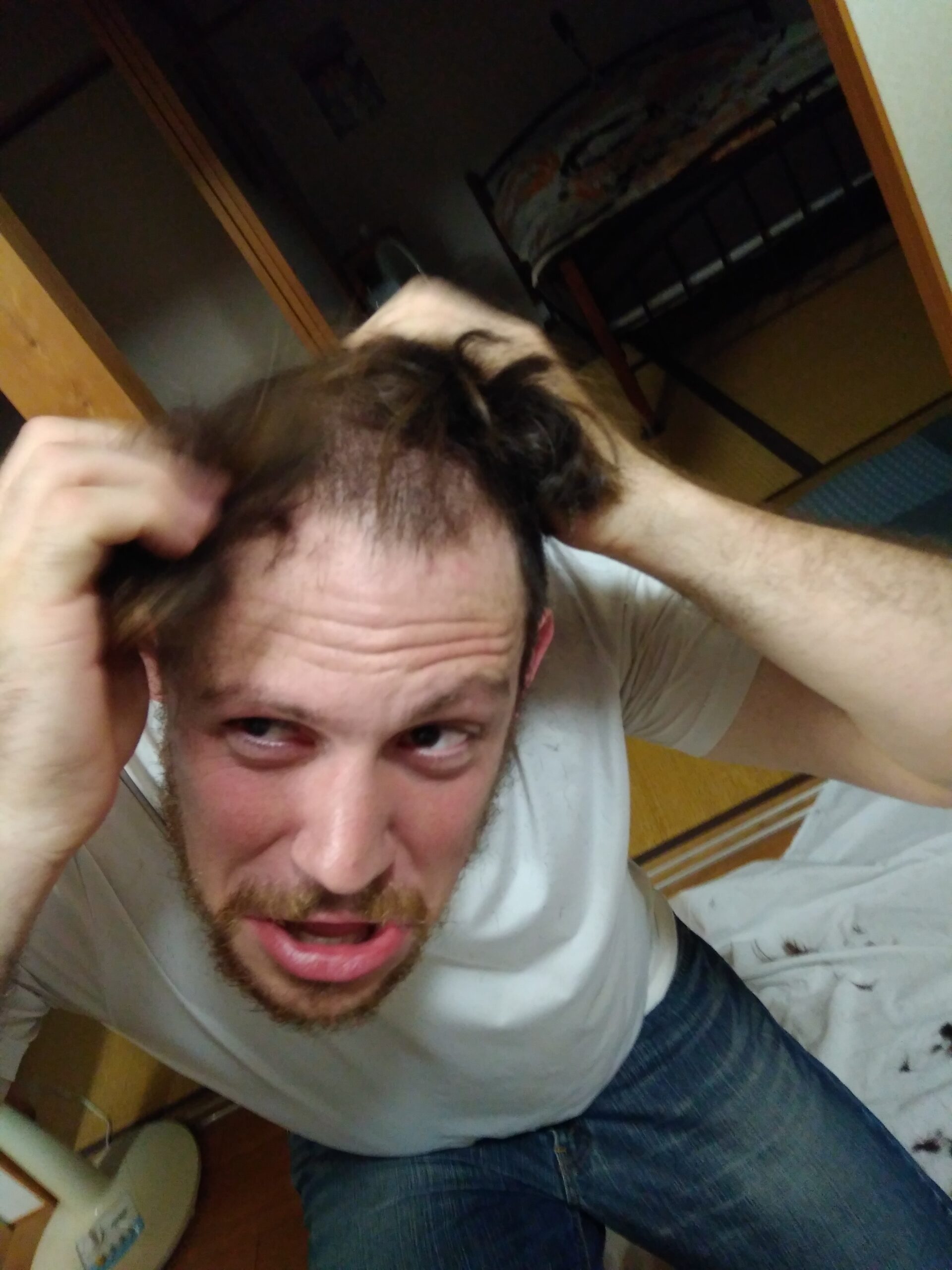David losing his hair